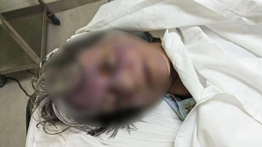 রাজধানীতে বিদেশি নাগরিককে পিটিয়ে হত্যার অভিযোগ